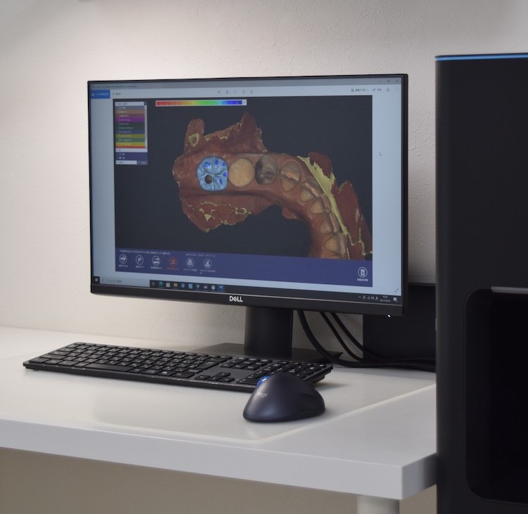 デジタル技工でより良いものを