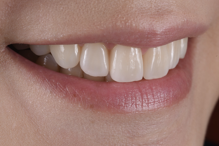 感動が生まれる技工物を目指して